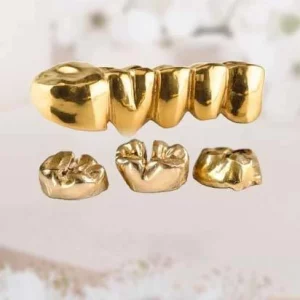 Zahngold Ankauf Hannover