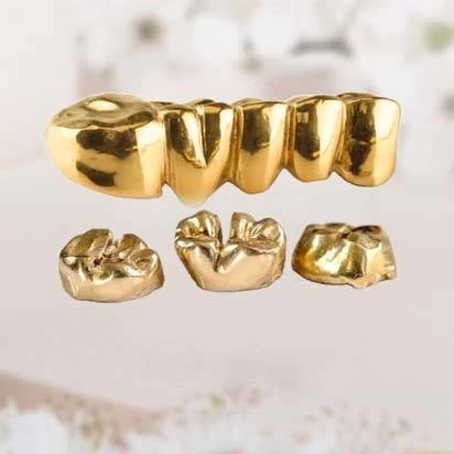 Zahngold Ankauf Hannover